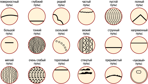 Схематическое изображение основных типов пульса